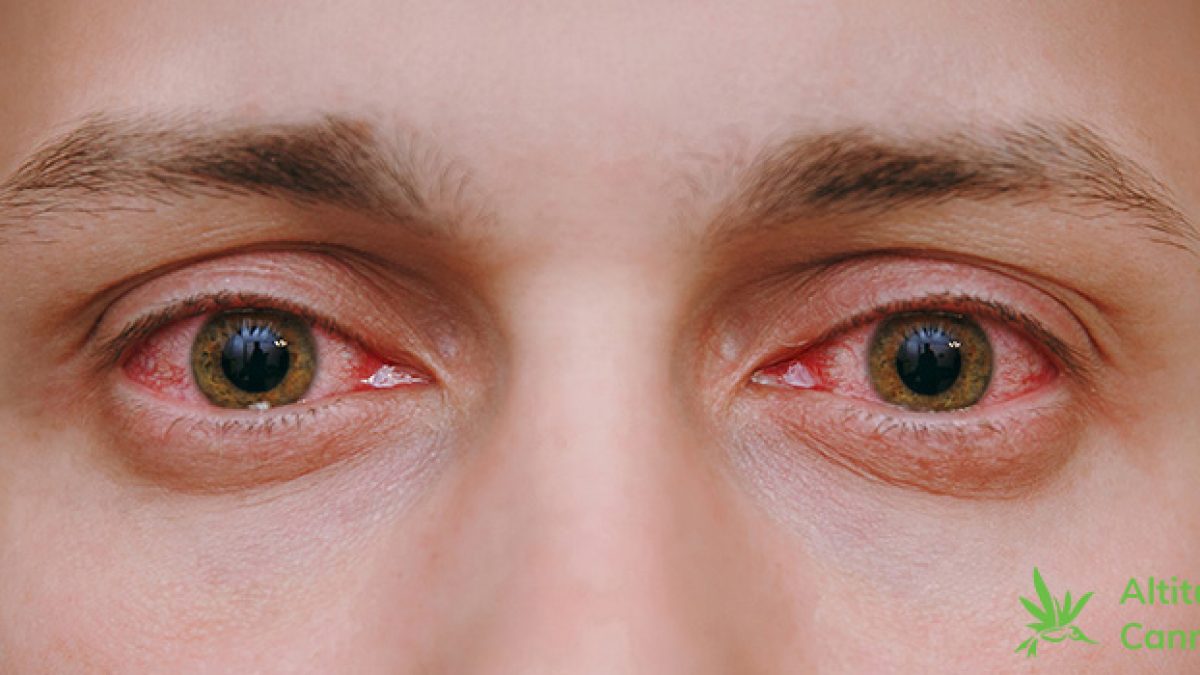 What Causes Bloodshot Eyes?